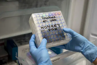 First case of monkeypox confirmed in South Africa